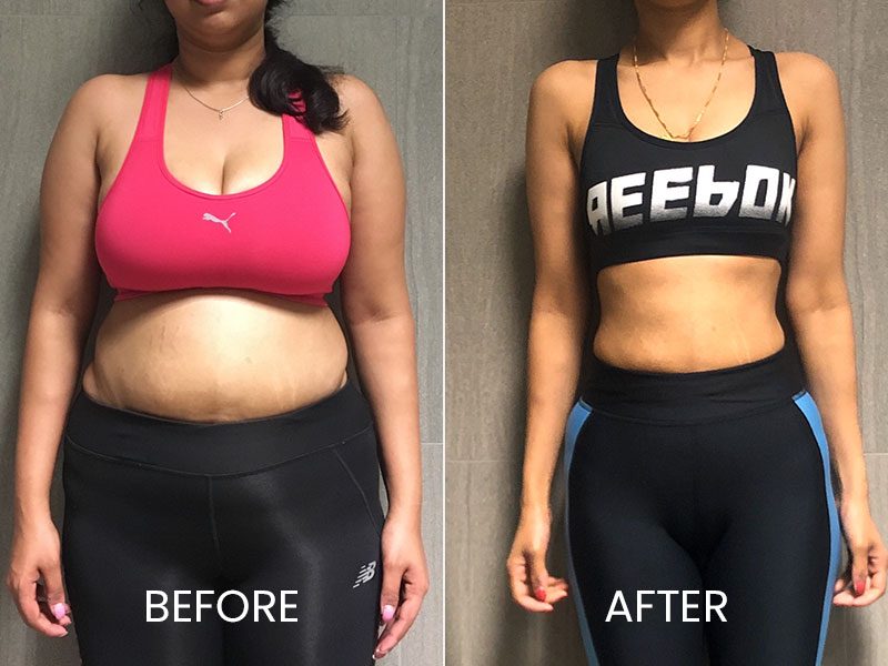 before and after figfitness